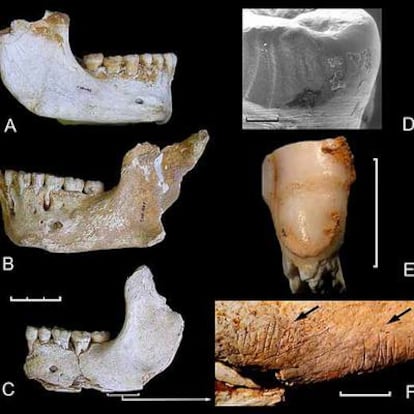 Fósiles neandertales de El Sidrón (Asturias), incluida una mandíbula con marcas de corte de prácticas caníbales (abajo a la derecha).