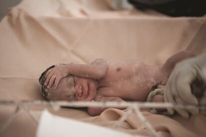 El bebé de Chantal es prematuro y viene de nalgas, y además la madre está en riesgo de sufrir una ruptura uterina. El equipo de MSF en Kabezi (Burundi) le practica una cesárea de urgencia. Ambos están bien, pero cada día, 800 mujeres mueren en el mundo por causas fácilmente evitables relacionadas con el embarazo y el parto.
