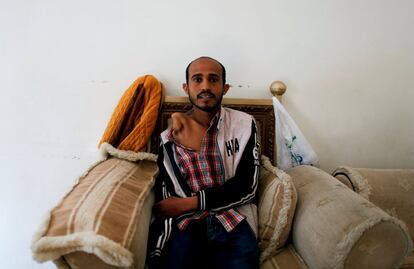 A Sultan Fareh, de 25 años, a quien le amputaron el brazo, posa en un centro solidario que acoge a pacientes de cáncer en Sanaa (Yemen).