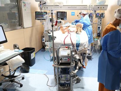 Un paciente tratado con la técnica ECMO en el Hospital Vall d'Hebron de Barcelona.