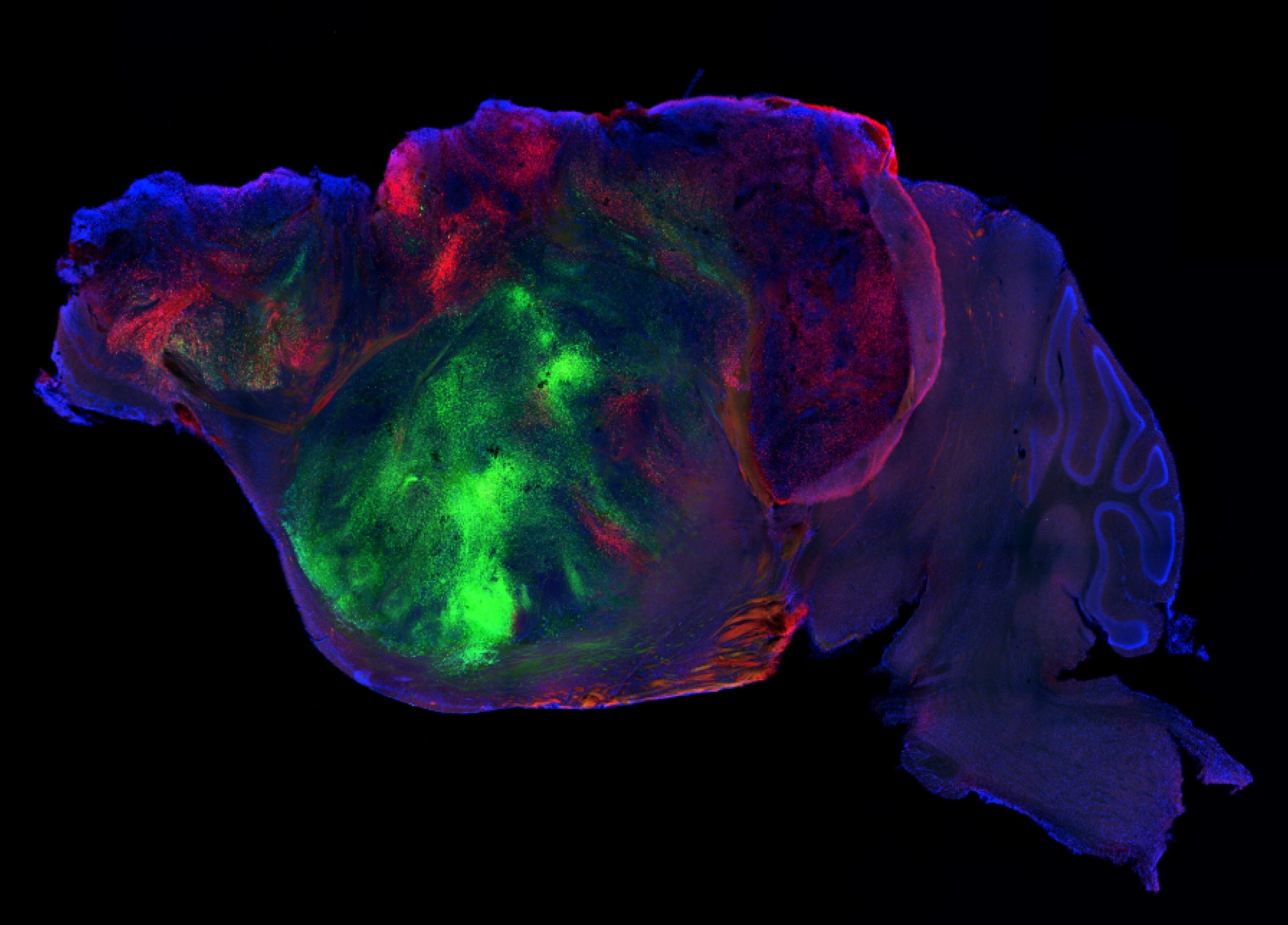 Vista al microscopio de las fibras nerviosas humanas, destacadas en rojo y verde, extendiéndose hacia el cerebro del ratón, en azul.