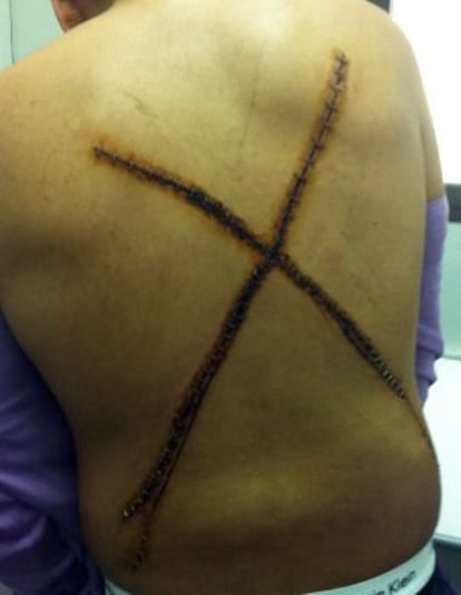 Marca realizada por Los Trinitarios en la espalda de la víctima.