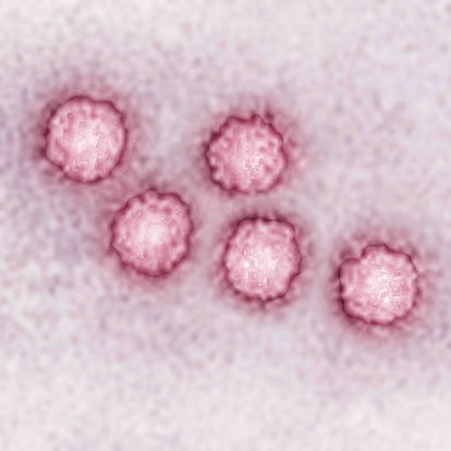 Hepatitis A