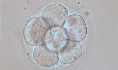 Embri&oacute;n humano en estado de 8 c&eacute;lulas ( 3 d&iacute;as de desarrollo embrionario in vitro)