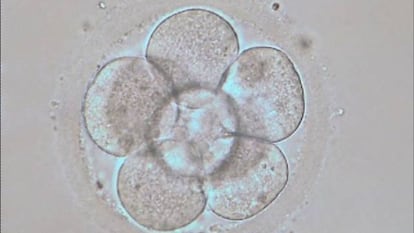 Embri&oacute;n humano en estado de 8 c&eacute;lulas ( 3 d&iacute;as de desarrollo embrionario in vitro)