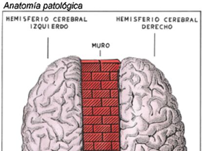 Anatomía patológica