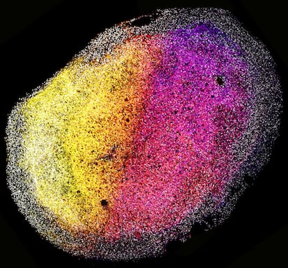 An image of a complete brain organoid from human fetal tissue.