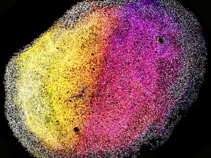 An image of a complete brain organoid from human fetal tissue.