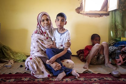 Buda no puede hacer nada por sí mismo, y su madre Zeinab agradece la ayuda de los vecinos. Su esperanza es que su hijo consiga ganar autonomía y que, al menos, pueda ir al baño él solo. 