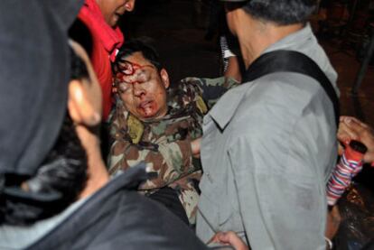 Khattiya SawaSdiphol, jefe militar de los <i>camisas rojas, </i>es atendido tras ser herido de un disparo.