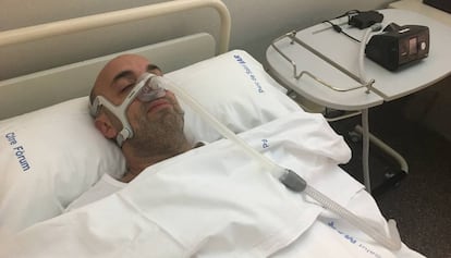 Un paciente con apnea del sueño usa el dispositivo CPAP para tratar esta dolencia