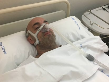 Un paciente con apnea del sueño usa el dispositivo CPAP para tratar esta dolencia