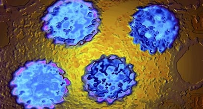 Los nuevos casos de tumores de garganta vinculados al VPH en España no llegan al millar al año.