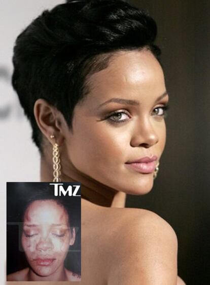 Rihanna cumple 21 años el 20 de febrero en medio de la polémica. Tras haberse hecho público el maltrato por parte de su novio, Chris Brown, ahora se ha filtrado una foto que la muestra con golpes y magulladuras. El padre de Rihanna, Ronald Fenty, se ha mostrado desilusionado con la policía. "Han hecho su trabajo bastante mal", ha dicho. El departamento de policía de Los Ángeles, por su parte, ha lanzado un comunicado en el que pide públicamente ayuda para descubrir cómo se filtró la imagen. "Una violación de este tipo es considerada una falta seria e implica sanciones que pueden llegar al despido", dice la nota. Con respecto a la celebración de su cumple, el padre de Rihanna ha revelado: "Que yo sepa, fiesta no habrá".