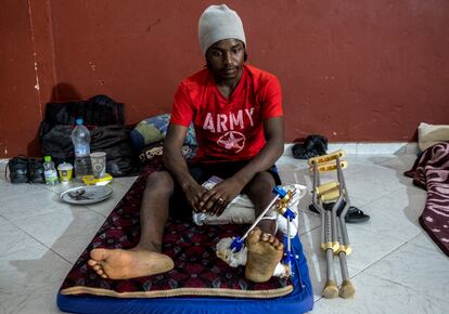Un chico sudanés de 16 años que se rompió el pie al llegar a Uchda, en la frontera de Argelia con Marruecos.