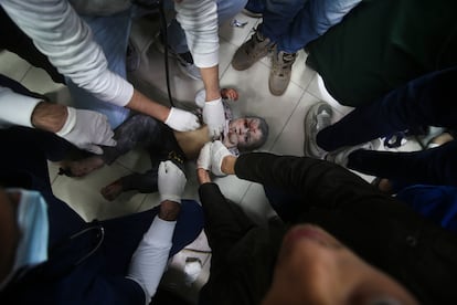 Un niño palestino herido en un ataque israelí es atendido este domingo en un hospital de Rafah, en el sur de Gaza.