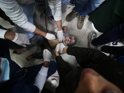 Un niño palestino herido en un ataque israelí es atendido este domingo en un hospital de Rafah, en el sur de Gaza.