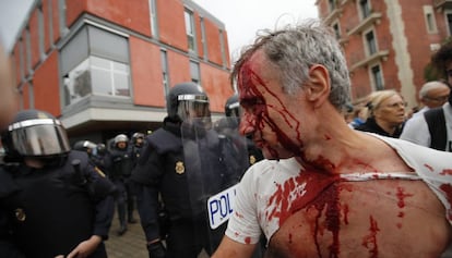 Herido después de la carga policial en la Barceloneta.