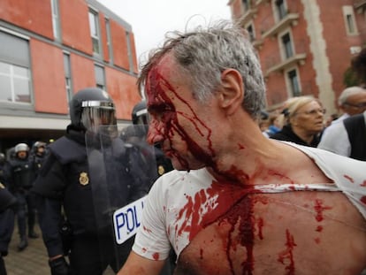 Herido después de la carga policial en la Barceloneta.