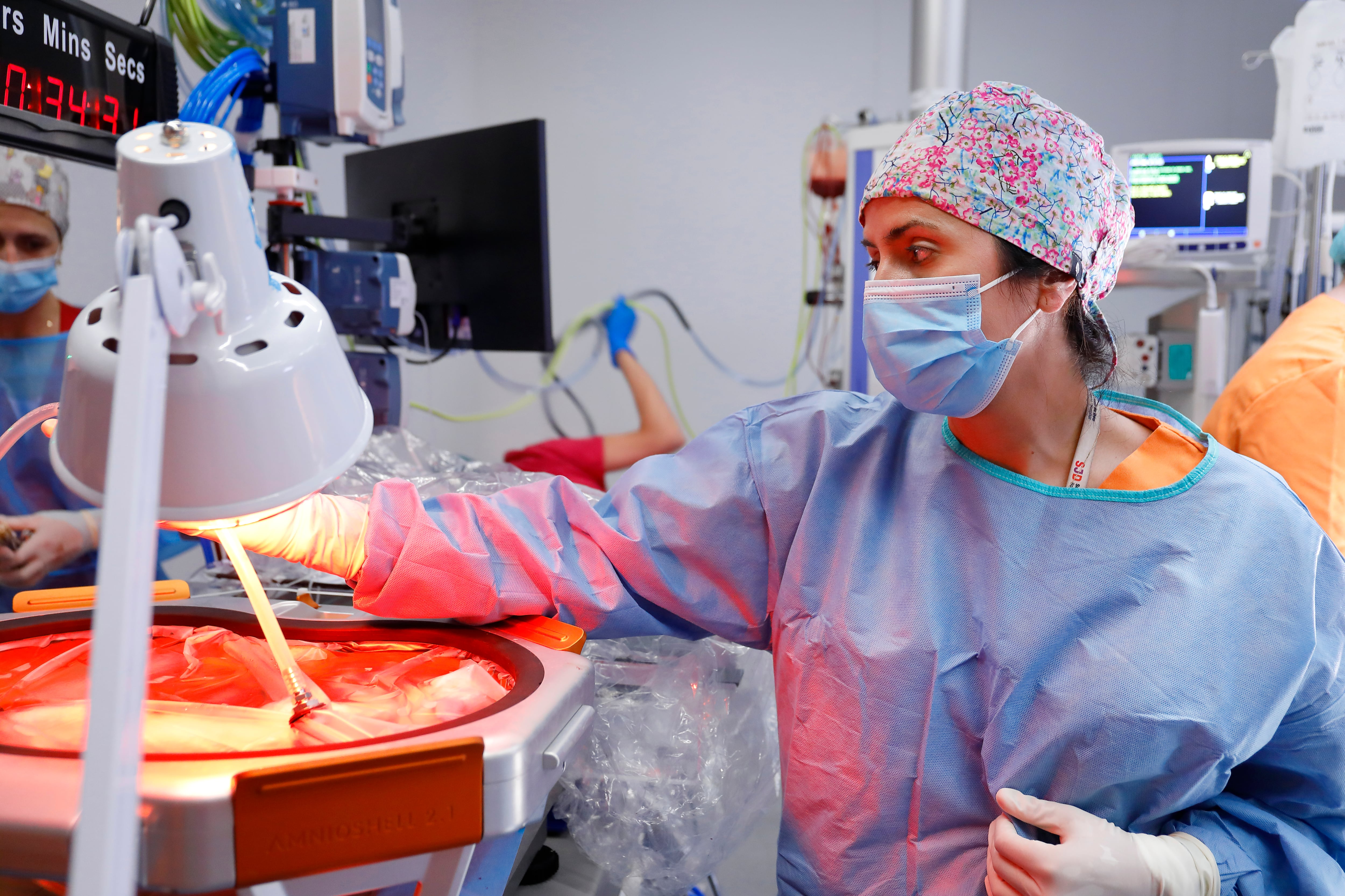 Un prototipo de placenta artificial para prematuros extremos logra mantener con vida un feto de oveja durante 21 días