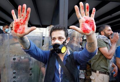 Un manifestantes con mascarilla enseña sus manos ensangrentadas por un enfrentamiento con el ejército libanés, en Beirut.