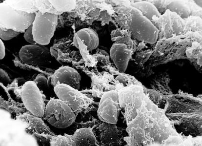 Scanning electron micrograph depicting a mass of Yersinia pestis bacteria (the cause of bubonic plague) in the foregut of the flea vector.