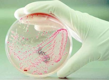 Cultivo de la bacteria <i>Escherichia coli</i> en laboratorio.