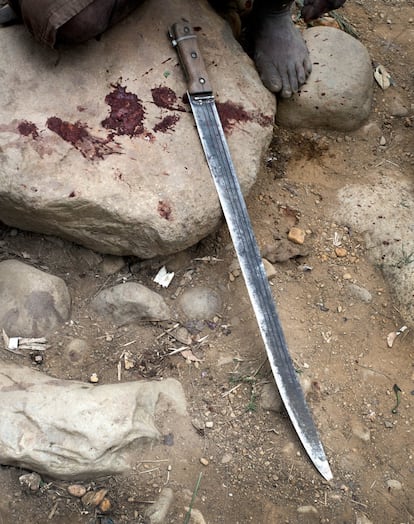 Un machete cubierto de zumo. En Tari, en la región de las tierras altas de Papúa Nueva Guinea, este tipo de cuchillo se utiliza durante los estallidos de violencia. Dos de cada tres supervivientes de violencia de género (69%) llegaron a los hospitales de MSF de Puerto Moresby y Tari con heridas provocadas por este tipo de arma, así como látigos u otros objetos contundentes.