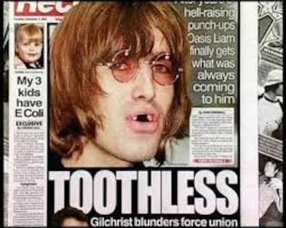 Un Liam Gallagher sin dientes copó las páginas de muchos diarios británicos tras su pelea en el bar del hotel Bayerischer Hof de Múnich en 2002.