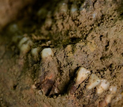 Detalle de las piezas dentales en la osamenta de la 'Señora SAS'.