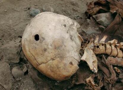 Cráneo de un inca muerto por arma de fuego