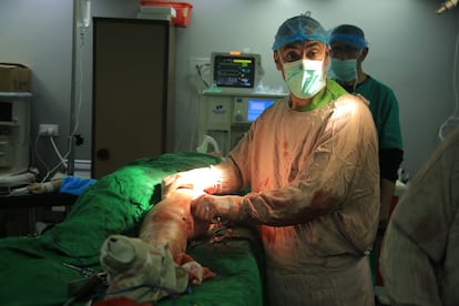 El cirujano Mohamed Obaid durante una intervención en el hospital Al Awda de Yabalia (Gaza), en una imagen cedida.