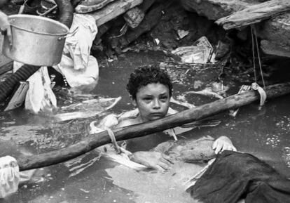 La niña Omayra Sánchez, atrapada tras la erupción del Nevado del Ruiz.