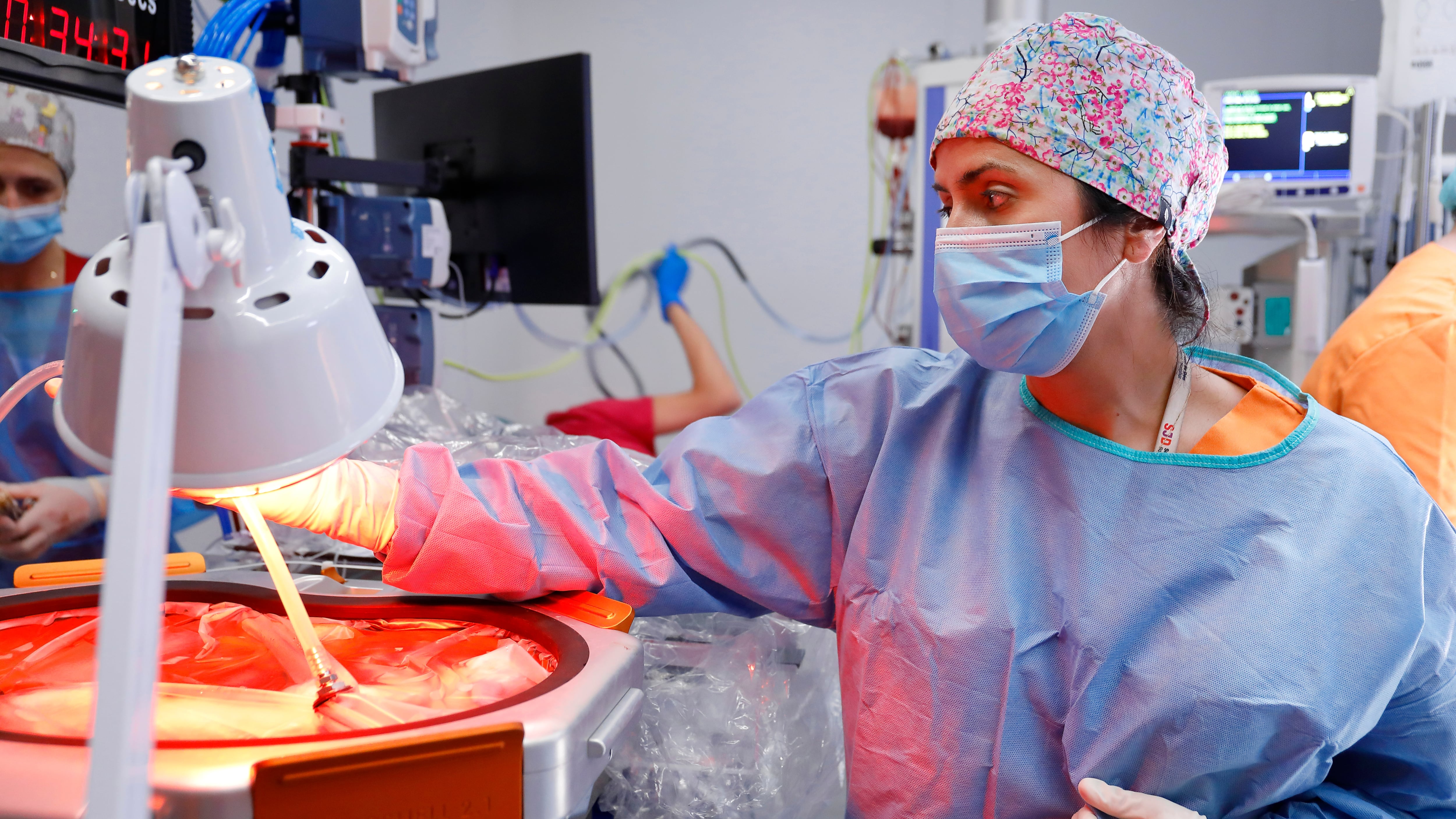 Un prototipo de placenta artificial para prematuros extremos logra mantener con vida un feto de oveja durante 21 días
