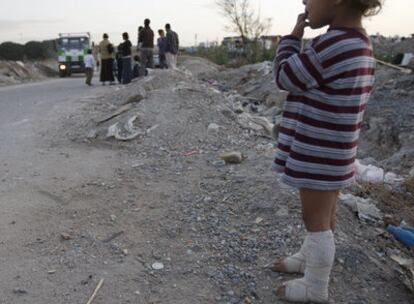 Camino que lleva al poblado de El Gallinero, en Valdemingómez. La niña de la imagen lleva vendas en los pies, quemados en el incendio de una chabola.