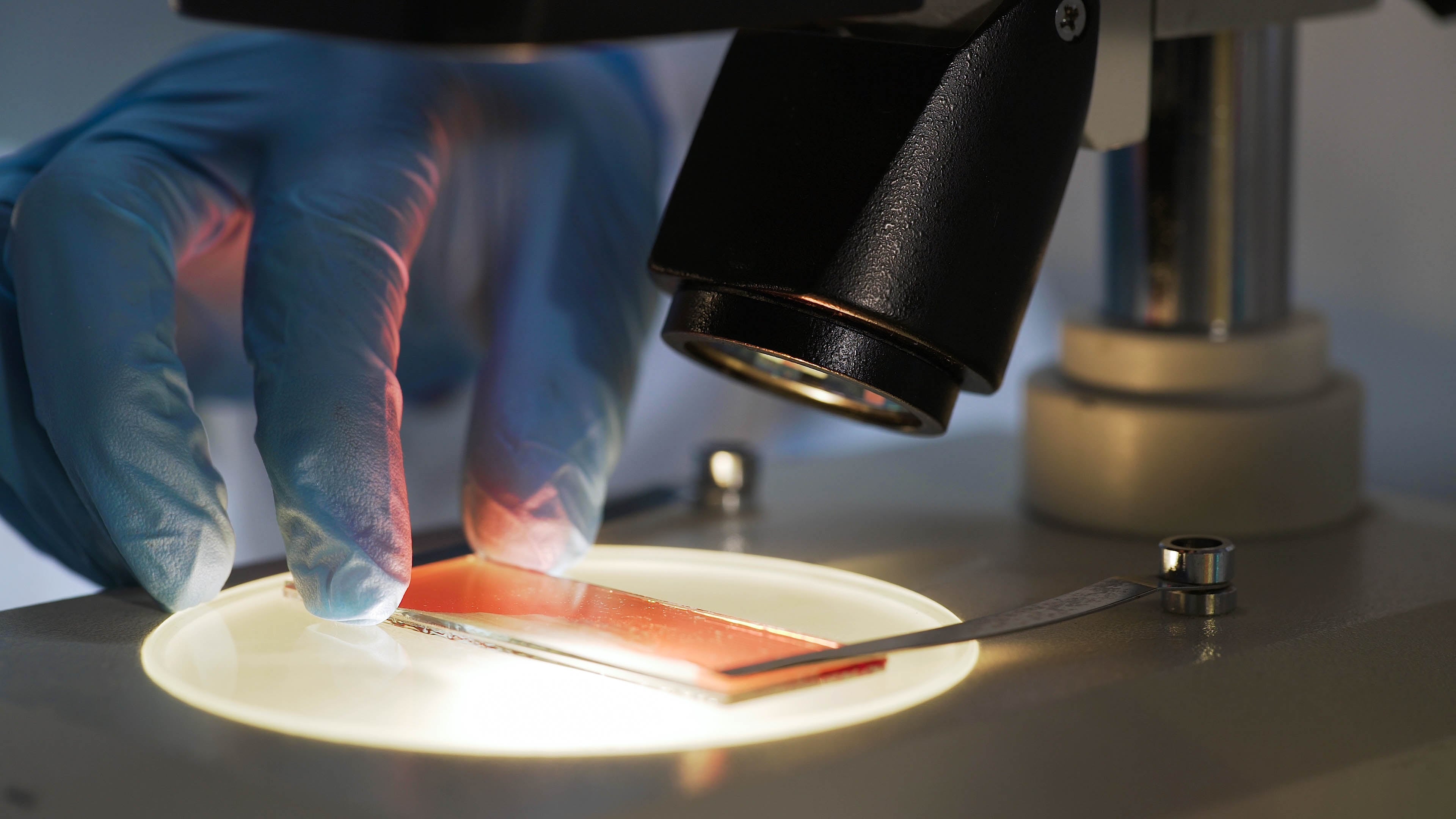 México autoriza el primer ensayo de producción local de células reprogramadas, un ‘medicamento vivo’ contra la leucemia