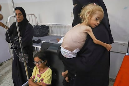 Islam Qudeih sostiene en brazos a su hija Shamm, de dos años y con desnutrición aguda, en el hospital Nasser de Jan Yunis, el 9 de agosto.