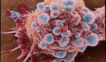 Célula de cáncer de mama.