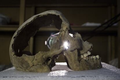 Varios de los cráneos encontrados muestran este tipo de modificación.