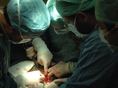 Un grupo de médicos practica una cesárea.  