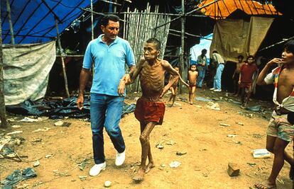 Hombre yanomami enfermo en 1990.