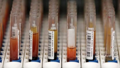 Muestras de sangre esperando para ser analizadas.