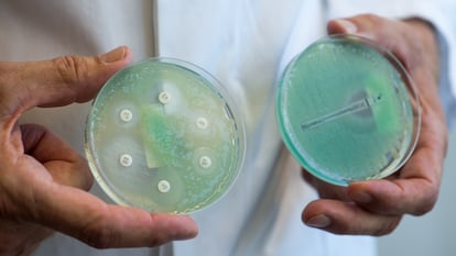 Una imagen de placas de prueba de antibióticos con 'Pseudomonas aeruginosa'.