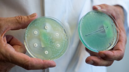 Prueba de antibióticos con 'Pseudomonas aeruginosa'.