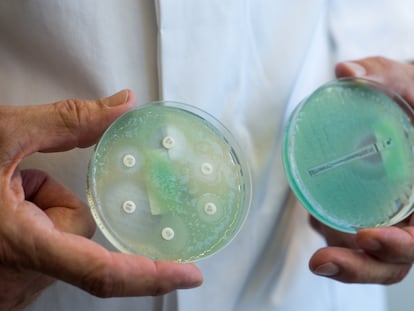 Pseudomonas aeruginosa