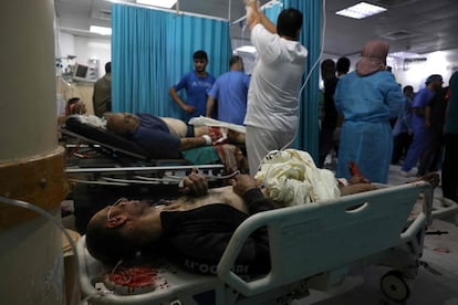 Varias personas heridas reciben cuidados en un hospital del norte de la franja de Gaza. La escalada de violencia durante el mes de Ramadán en Jerusalén registró este lunes la jornada con mayor tensión. Al menos 305 palestinos han resultado heridos, de los que 228 han tenido que ser hospitalizados, según la Media Luna Roja, en choques con la policía israelí durante el rezo de la mañana en la mezquita de Al Aqsa, tercer lugar sagrado del islam.