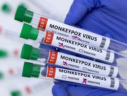 Samples from patients suspected of having monkeypox with test results noted on the label.