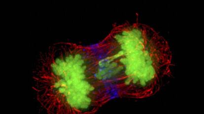 Dos células de cáncer dividiéndose.