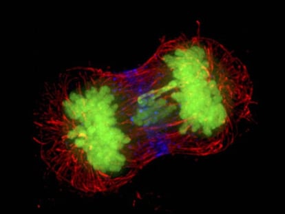 Dos células de cáncer dividiéndose.