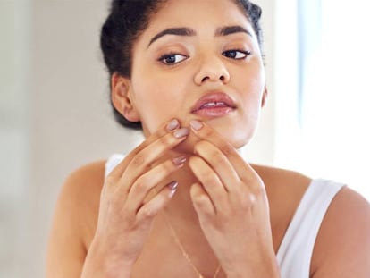 El cosmético "mágico" con el que eliminar los granitos causados por la mascarilla